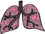 Vitamin D Helps Cure Tuberculosis