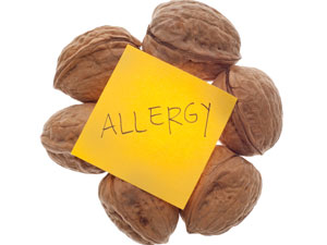 06 04 Food Cause Allergy 06 04 Food Cause Allergy