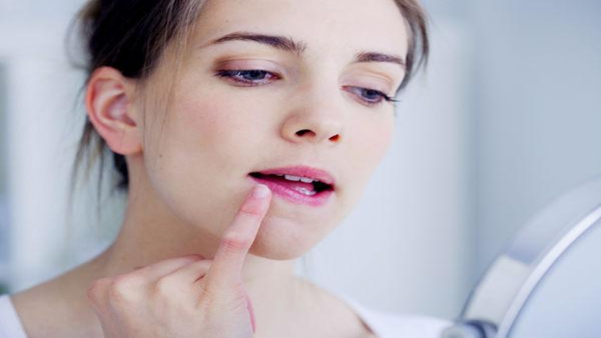 വരണ്ട ചുണ്ടുകളോ, പരിഹാരമുണ്ട്.... Foods For Chapped Lips Malayalam BoldSky