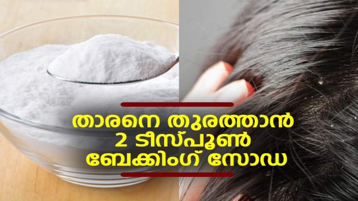 How To Use Baking Soda For Dandruff താരനെ തുരത്താന്‍ 2 ടീസ്പൂണ്