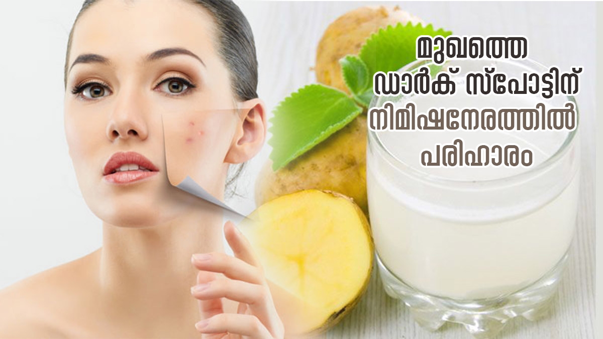 കറുത്ത പാടുകള്‍ നീക്കി തിളക്കമുള്ള മുഖം ഉറപ്പ്; ഉരുളക്കിഴങ്ങ് ജ്യൂസ്