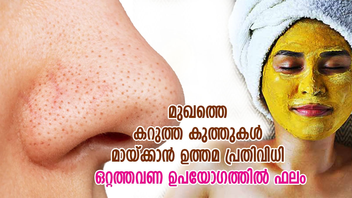 മുഖത്തെ ബ്ലാക്ക്ഹെഡ്സ് നീക്കാന്‍ മഞ്ഞള്‍; ചുരുങ്ങിയ ഉപയോഗത്തില്‍ ഫലം