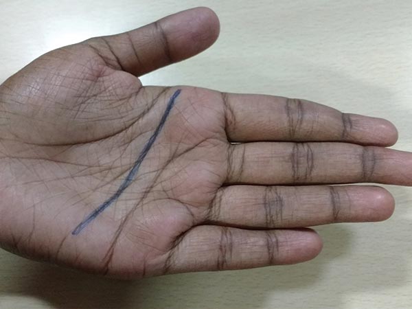 ഹെഡ്ലൈന്