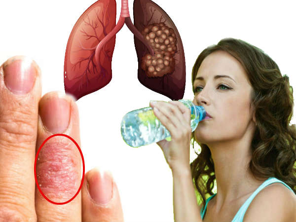 Health Effects Of Plastic Water Bottles