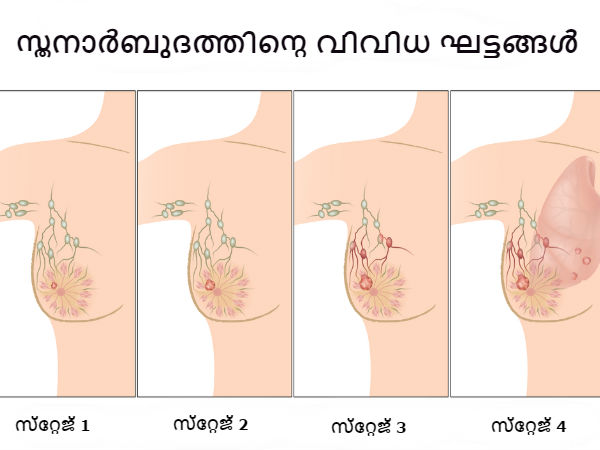എല്ലാം ക്യാന്സര് ലക്ഷണമല്ല