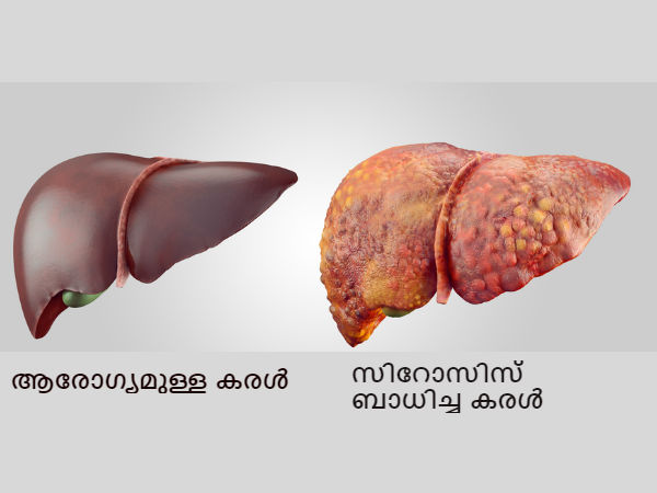 ത്വക്കിന് മഞ്ഞനിറം
