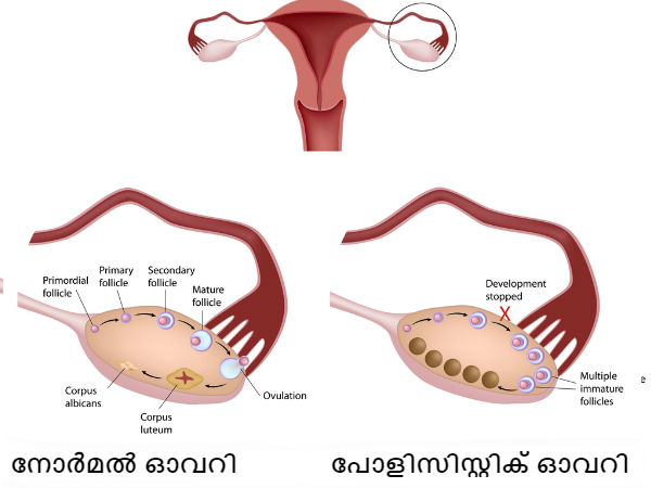 മുടി കൊഴിച്ചില്