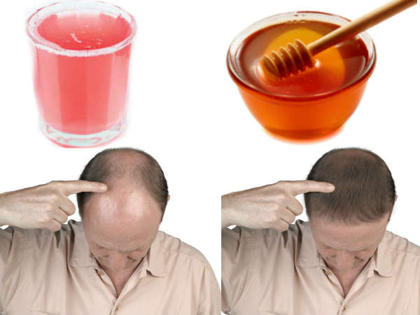 ഉപയോഗിക്കേണ്ട വിധം