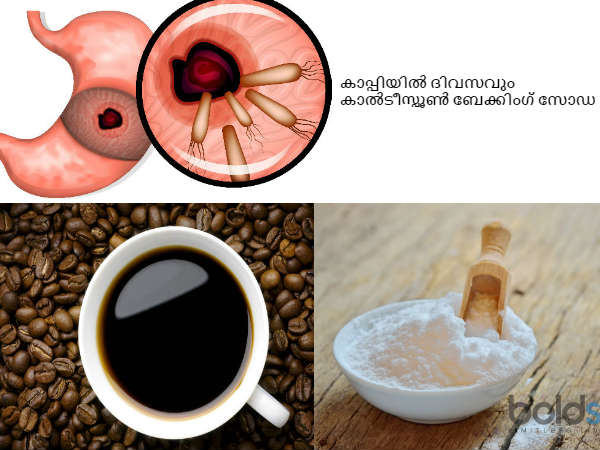 അമിത കൊഴുപ്പ്