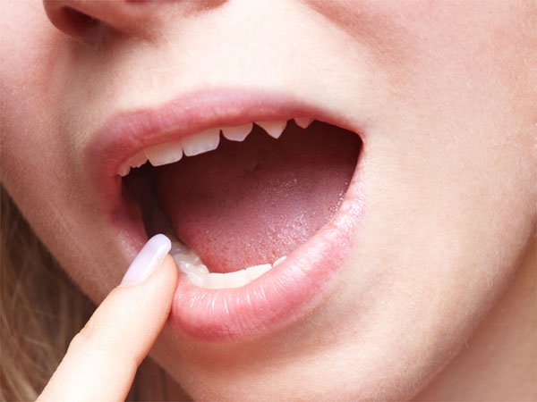 à´¤ à´£ à´Ÿà´¯ à´² à´• à´¯ à´¨ à´¸à´° à´¤ à´Ÿà´• à´•à´²à´• à´·à´£à´™ à´™à´³ Early Symptoms Of Throat Cancer Malayalam Boldsky