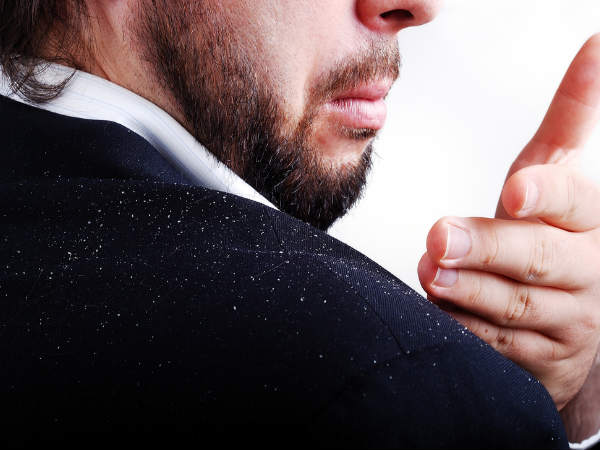 എണ്ണമയമുള്ള താരന്(Oily Scalp-Related Dandruff )