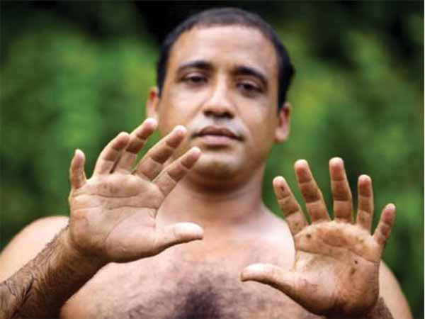 രോഗങ്ങള് തടയാന്