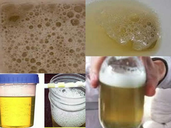 ചില രോഗങ്ങളെങ്കില്