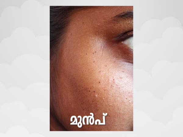 ഹൈഡ്രജന് പെറോക്സൈഡ്