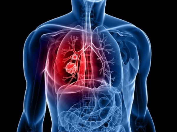 lungs health during coronavirus : കോവിഡില് നിന്ന് ശ്വാസകോശം കാക്കാം; ഈ ശീലങ്ങള് 8 മദ്യം