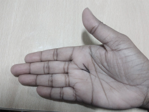 ഹൃദയരേഖ ബ്രെയിന് ലൈനില് മുട്ടിയാല്