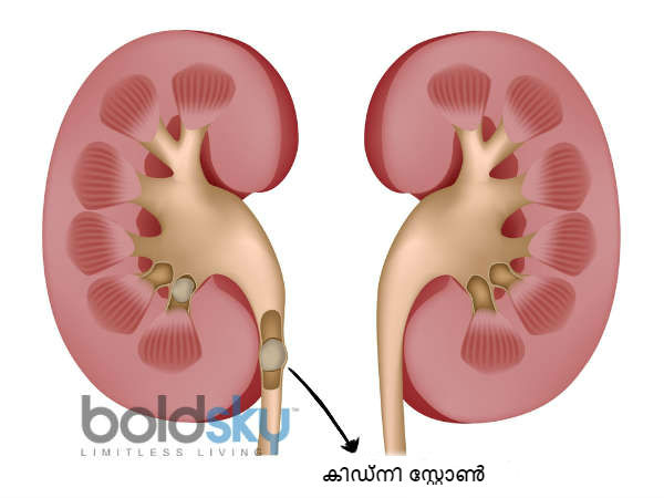 സസ്യങ്ങള് കൂടുതല് ഉള്പ്പെടുത്തുക