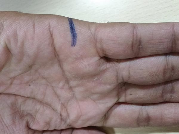 ചെറുവിരലിന് അടുത്ത്