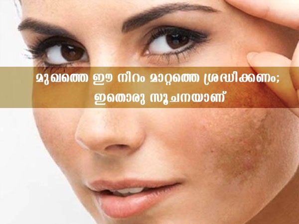 ഈ നിറം മാറ്റം ശ്രദ്ധിക്കണം; ദിവസങ്ങള്‍ക്കുള്ളിലുണ്ട് പരിഹാരം | How To