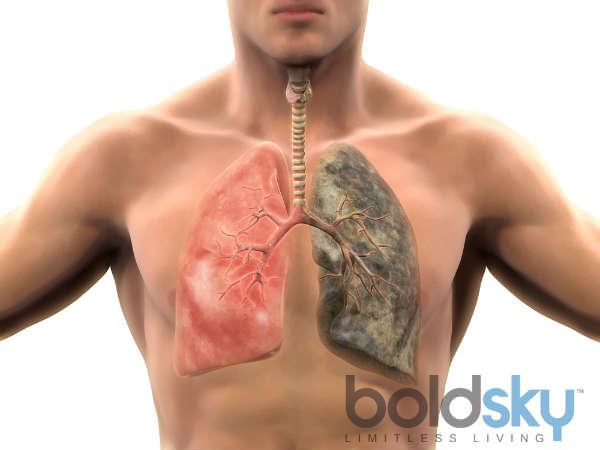 എന്താണ് COPD-ക്ക് കാരണമാകുന്നത്?