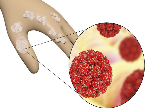 ഹ്യൂമന് പാപ്പിലോമ വൈറസ് (HPV)