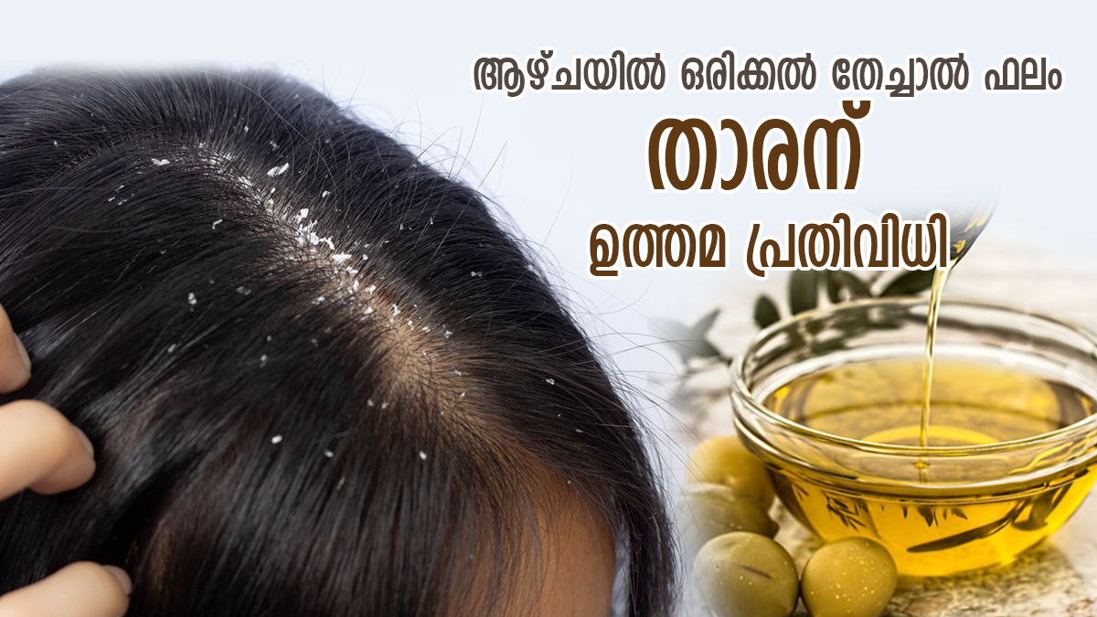 താരന്‍ വന്നാല്‍ പോകാന്‍ അല്‍പം പ്രയാസം; ഈ എണ്ണ ആഴ്ചയില്‍ ഒരിക്കല്