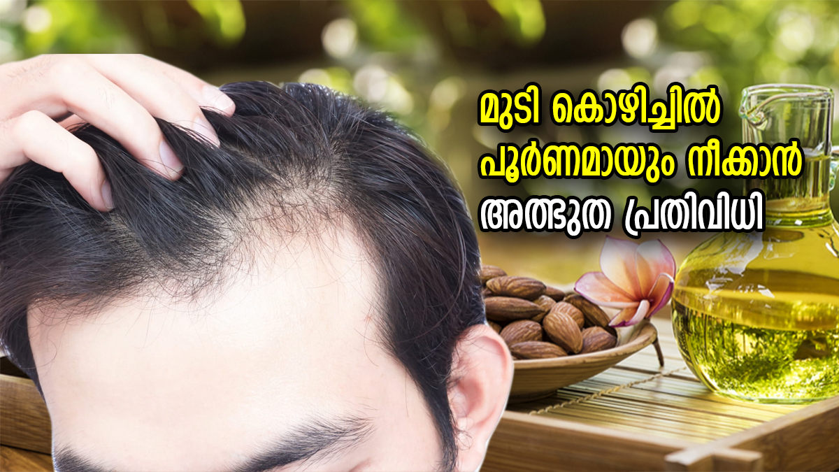 മുടി കൊഴിച്ചില്‍ നിയന്ത്രിക്കാന്‍ ഒരു മാന്ത്രിക എണ്ണ; ആഴ്ചയില്