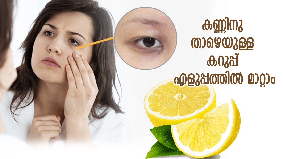 കണ്ണിനു ചുറ്റുമുള്ള കറുപ്പ് നിശ്ശേഷം നീക്കാം; ഈ 4 വിധത്തില്‍ നാരങ്ങ ഉപയോഗിക്കൂ Use Lemon In