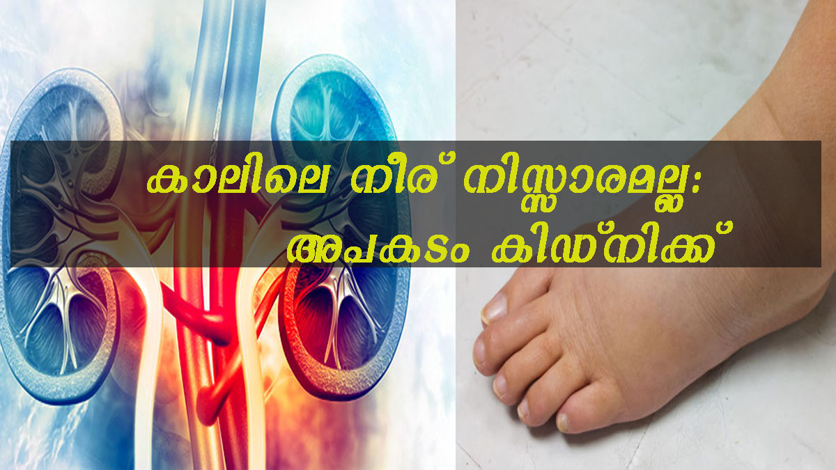 കാലില്‍ നീര് ഇങ്ങനെയെങ്കില്‍ കിഡ്‌നിക്ക് ഗുരുതര തകരാറ് വേദനയും
