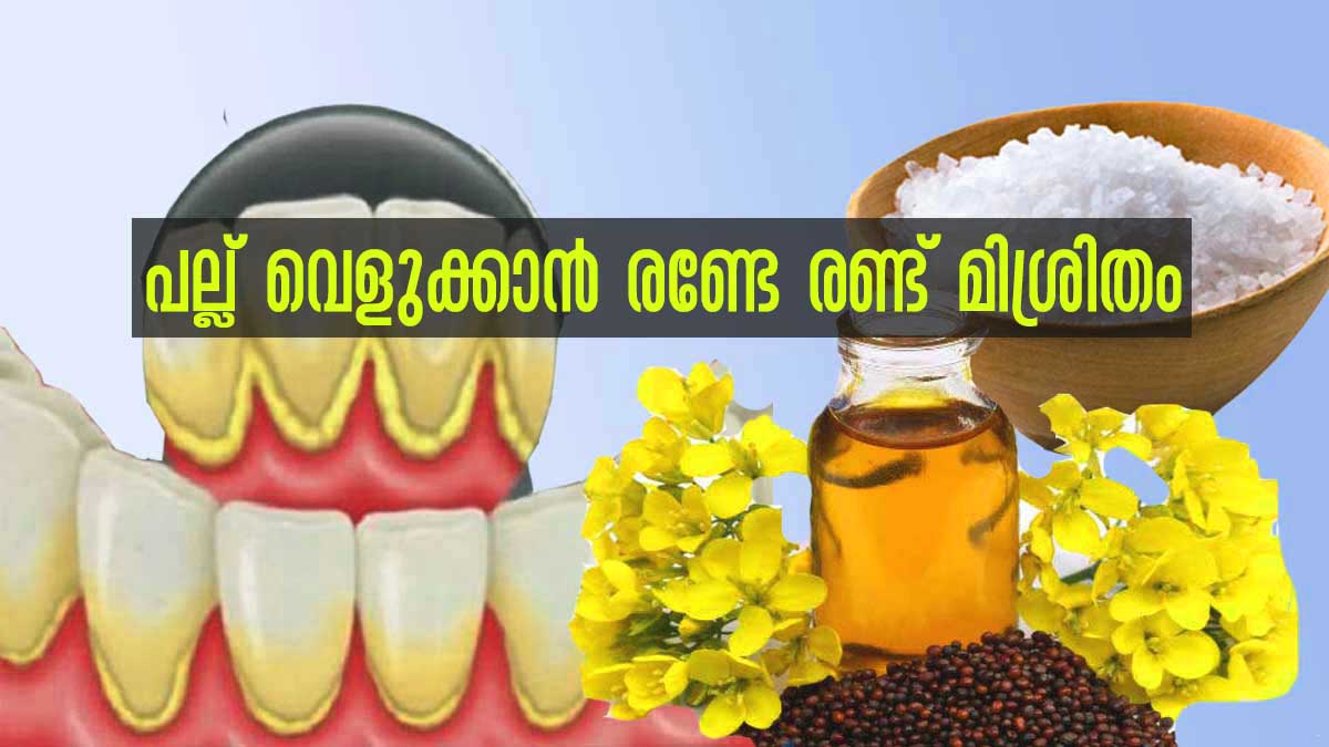 പല്ലിലെ മഞ്ഞ നിറത്തെ പാടേ അകറ്റി മുത്ത് പോലെ തിളങ്ങാന്‍ ഉപ്പും