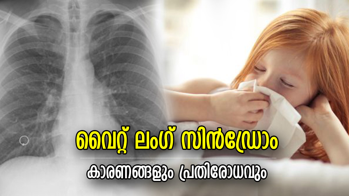 White Lung Syndrome Signs Symptoms And Preventive Measures You Should Know