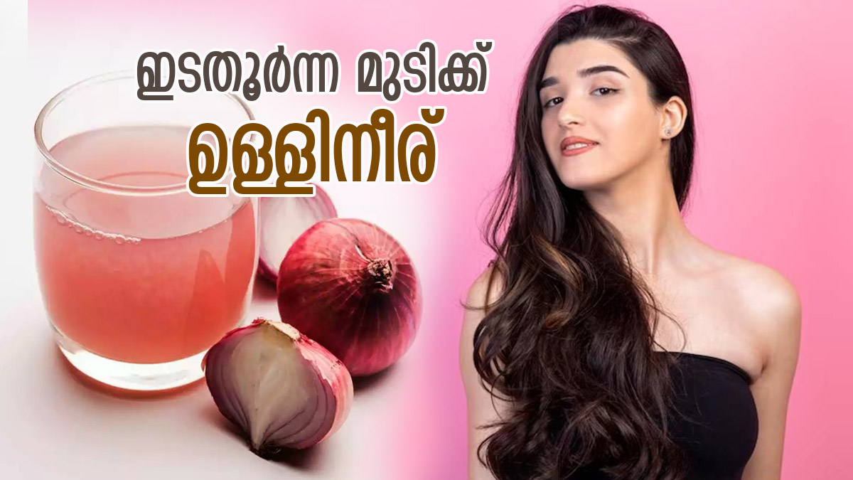 മുട്ടറ്റം മുടിക്ക് ഉള്ളിനീരിലുണ്ട് പ്രതിവിധി, ഇടതൂര്‍ന്ന കാര്‍കൂന്തലിന്